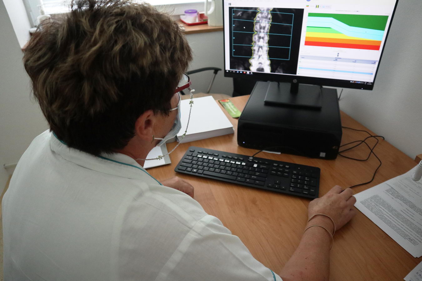 Denzitometria je ideálna metóda na včasnú diagnostiku osteoporózy